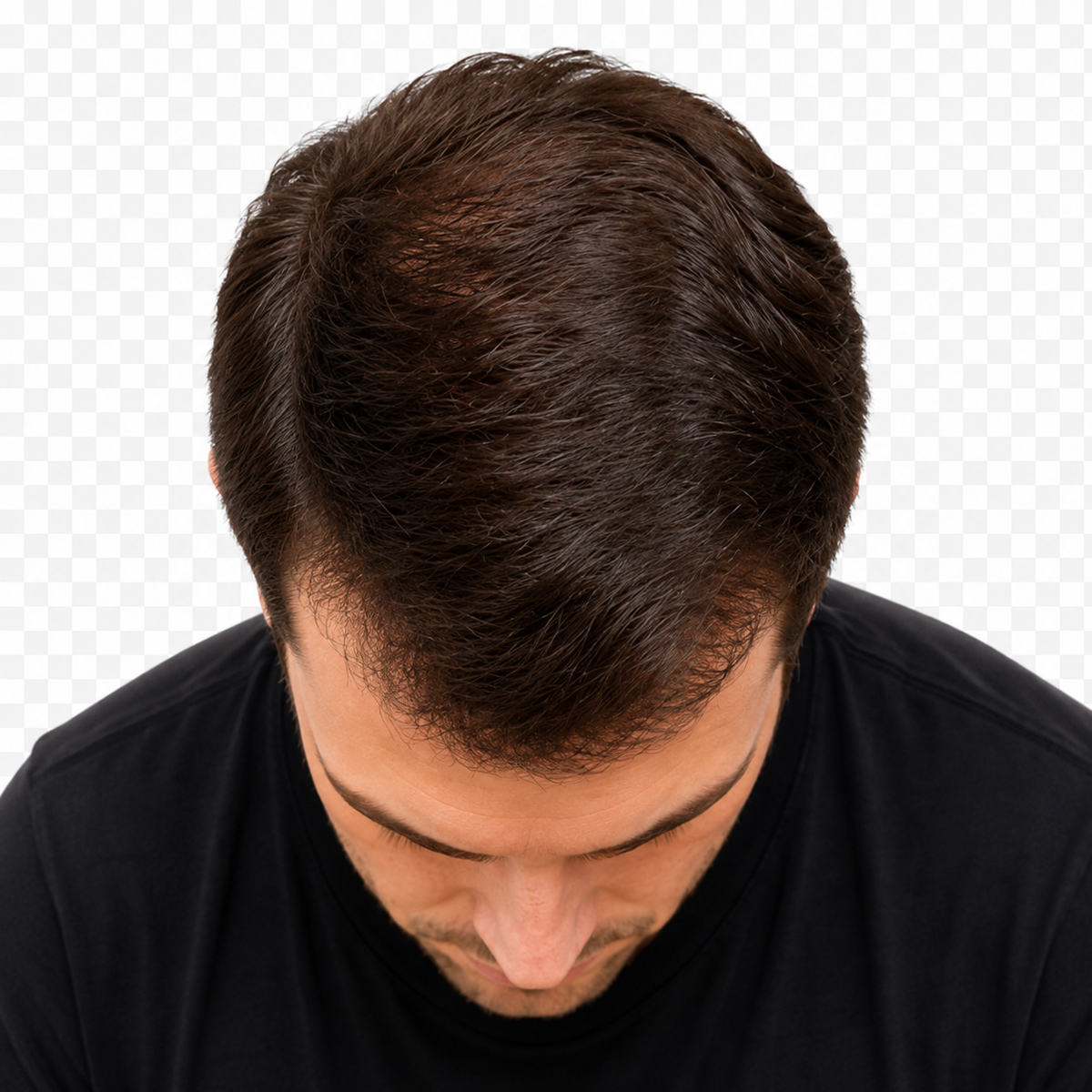 After image