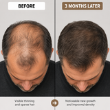 Hair Growth Supplements with Biotin for Women & Men – LushMaster™ Delivery Technology Scalp Treatment & Vitamins for Thicker, Stronger Hair Health, Drug-Free 30-Day Supply
