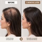 Hair Growth Supplements with Biotin for Women & Men – LushMaster™ Delivery Technology Scalp Treatment & Vitamins for Thicker, Stronger Hair Health, Drug-Free 30-Day Supply