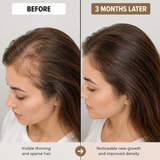 Hair Growth Supplements with Biotin for Women & Men – LushMaster™ Delivery Technology Scalp Treatment & Vitamins for Thicker, Stronger Hair Health, Drug-Free 30-Day Supply