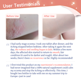 NatureU HISTA DISSOLVE Allergy Relief DAOMaster®+ VD+Soothing Probiotics(BB536) 30 Tablets/Bottle